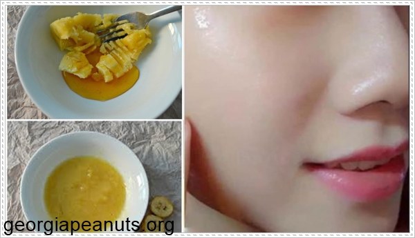 Mặt nạ mật ong với chuối trị mụn