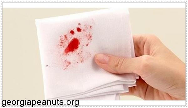 Đi cầu đau r&aacute;t hậu m&ocirc;n v&agrave; chảy m&aacute;u