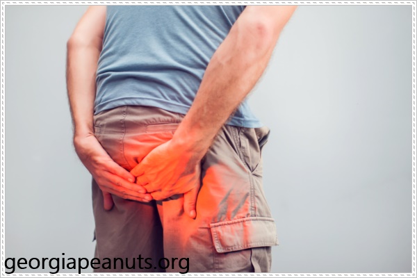 Trĩ ngoại g&acirc;y n&oacute;ng r&aacute;t hậu m&ocirc;n