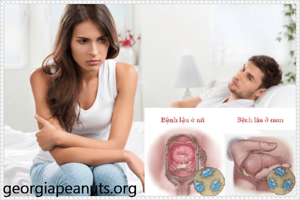 Dấu liệu của bệnh lậu