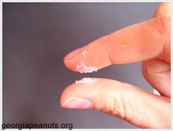 Biểu hiện của kh&iacute; hư v&oacute;n cục