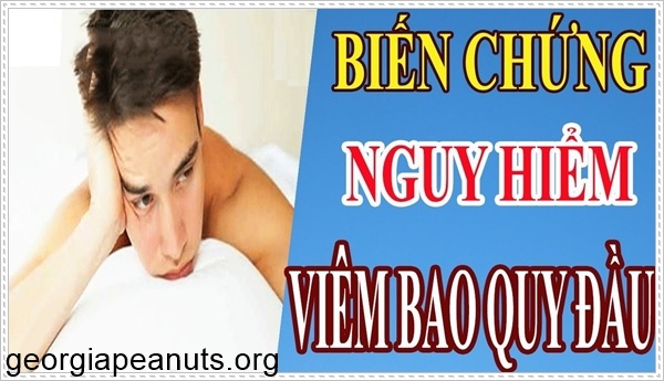 Biến chứng của vi&ecirc;m bao quy đầu
