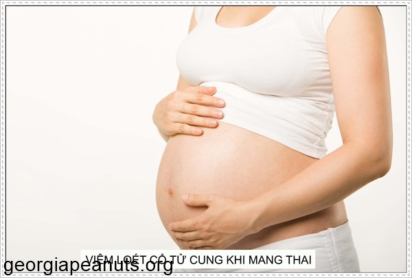 Viêm loét cổ tử cung hay xuất hiện ở phụ nữ sinh đẻ